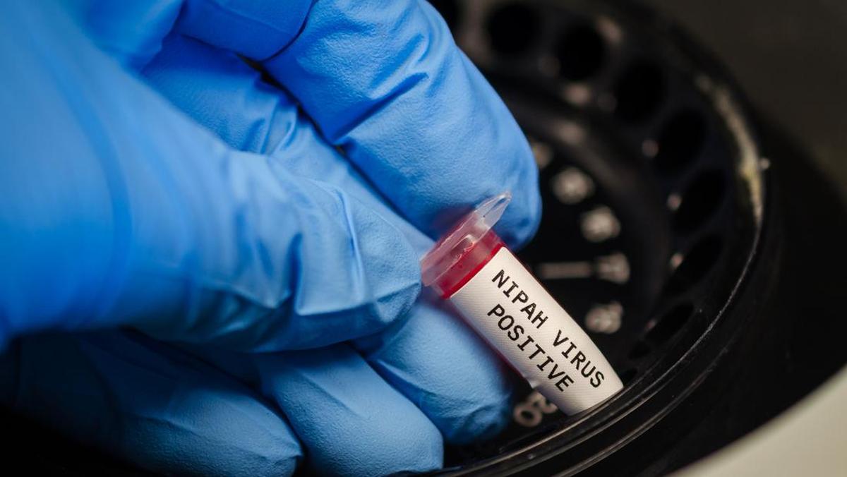 Video Virus Nipah Mewabah di India, Thailand Berlakukan Skrining di Bandara