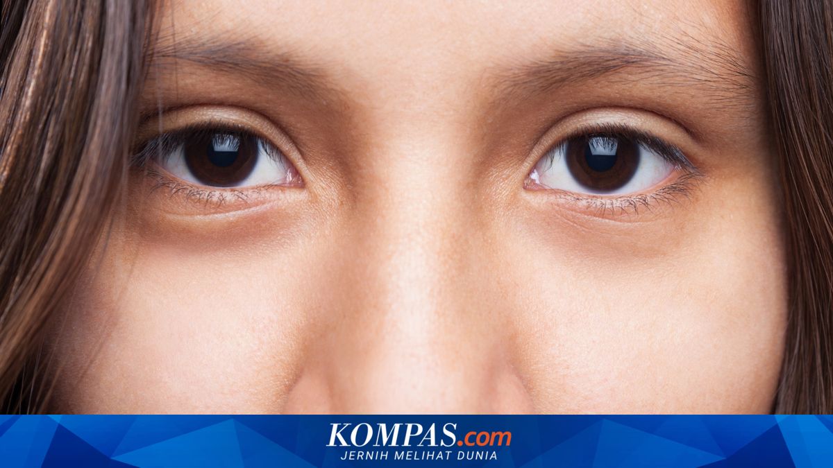 Manfaat Kandungan Peptide untuk Atasi Kantung Mata